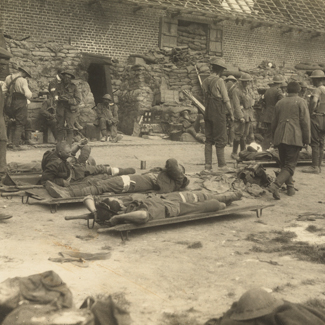 1917_7 June-wounded Battle of Messines